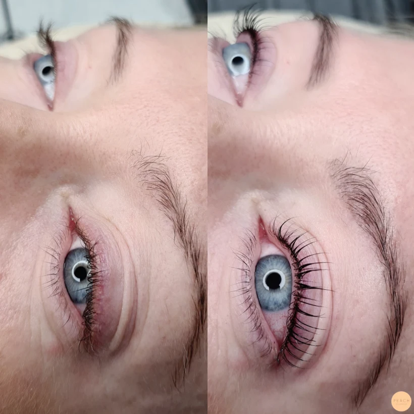 Yumi lashes franslyft