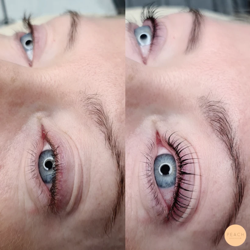 Yumi lashes franslyft