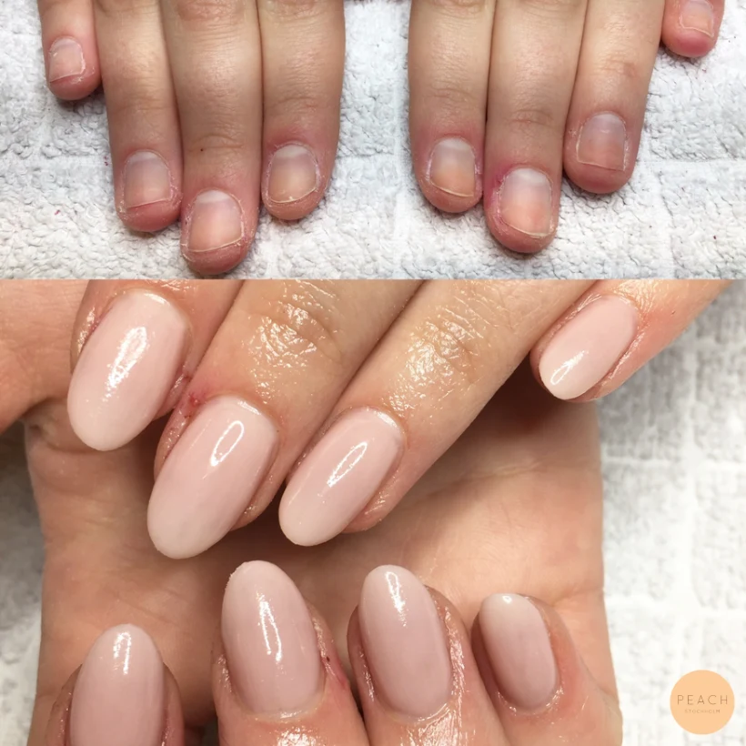 Nagelförlängning på nagelbitare med röda toner