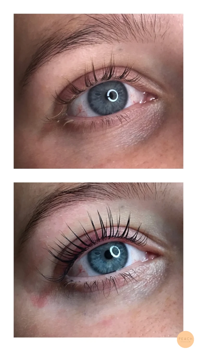 Andra behandlingen av Yumi lashlift