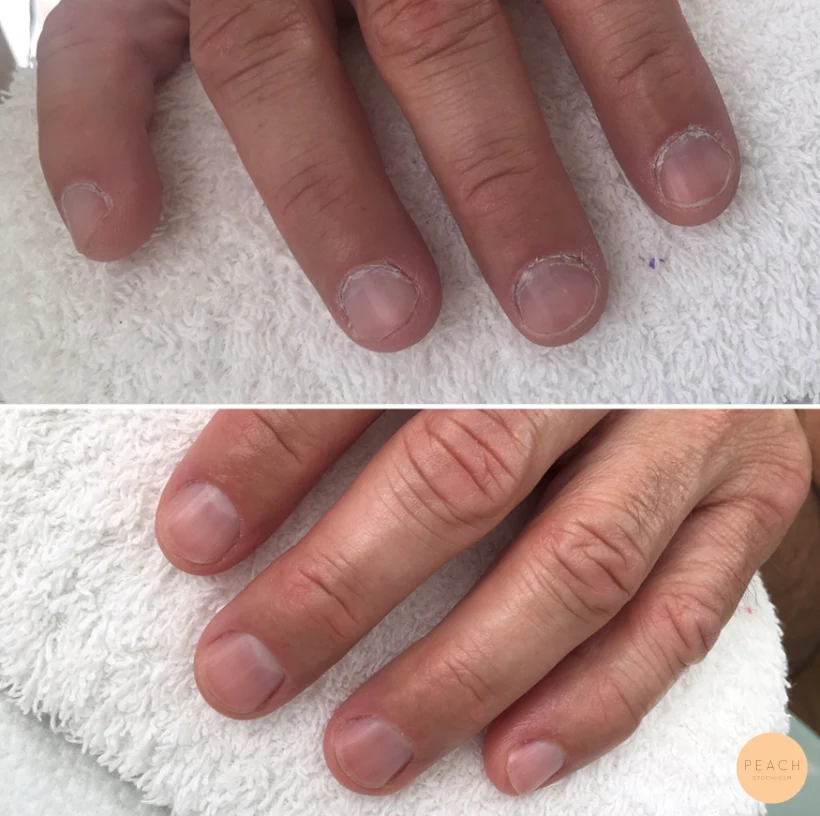 Manicure - (man)icure
