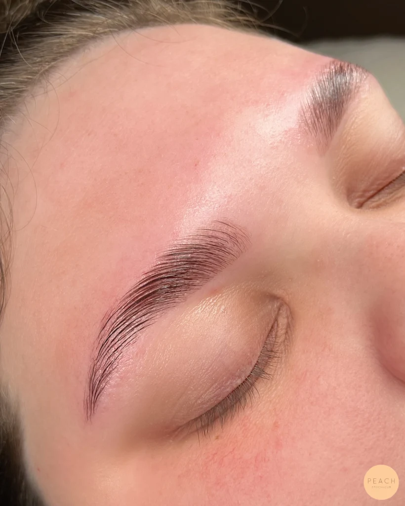 Browlift och brynformning