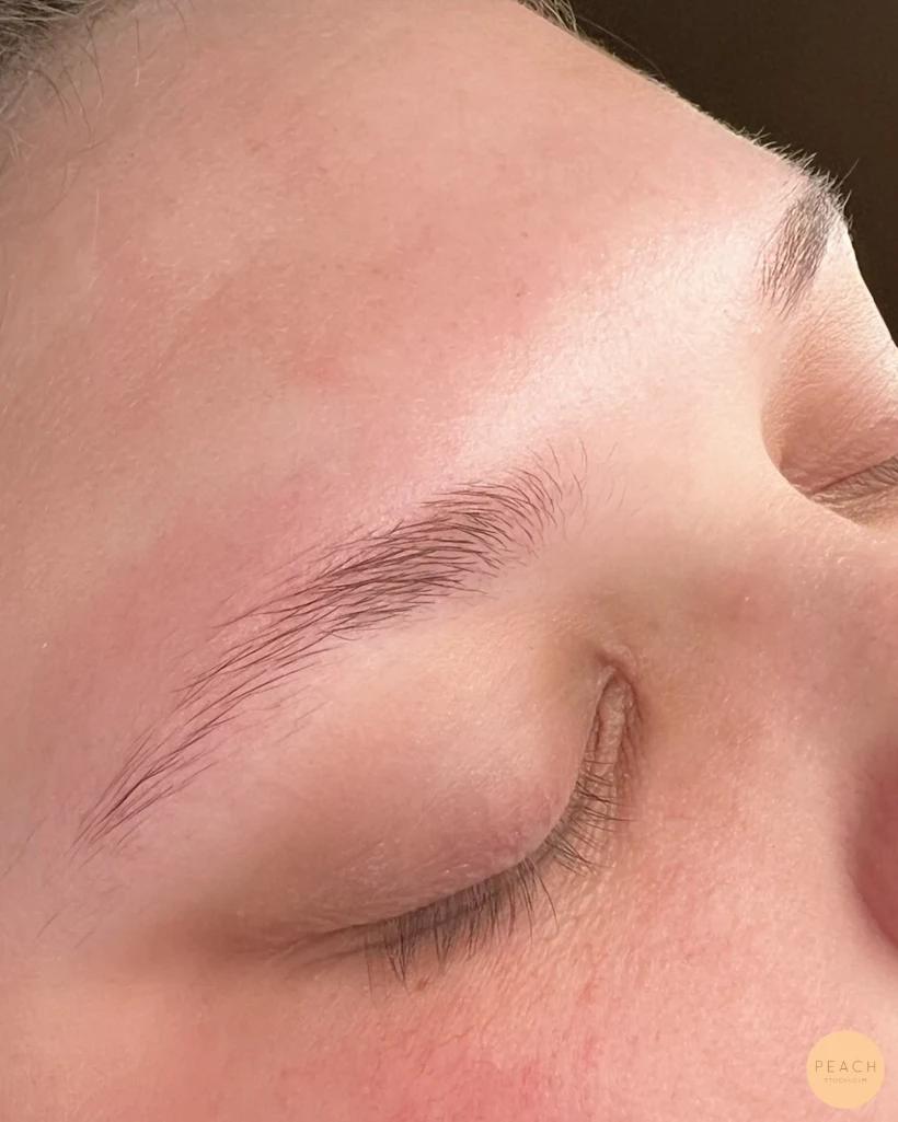 Browlift och brynformning